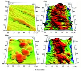 灭活细菌生物膜杂化钛金属材料的生物活性研究